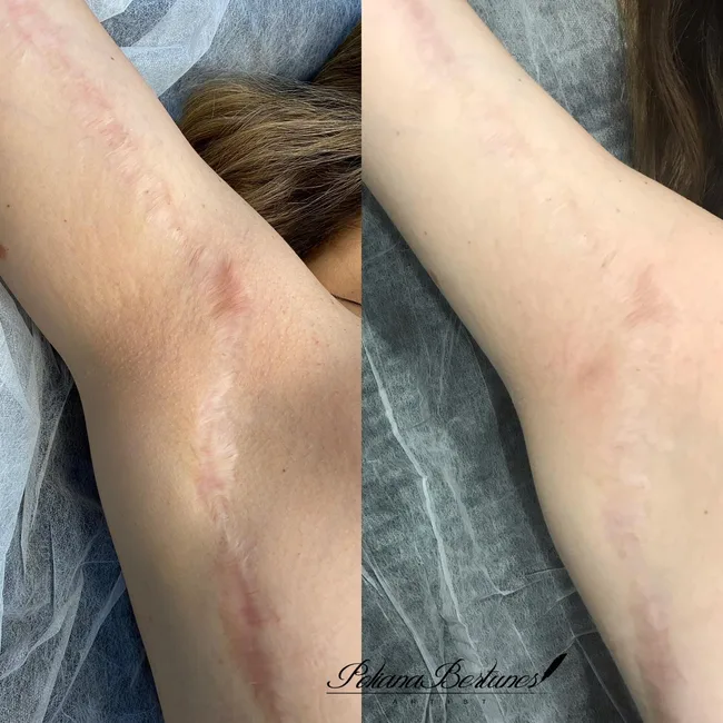 Camuflagem resultado