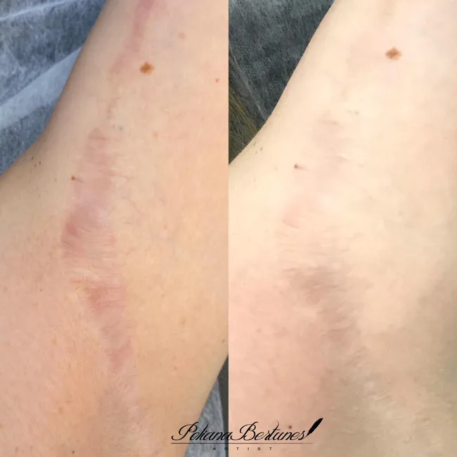 Camuflagem resultado