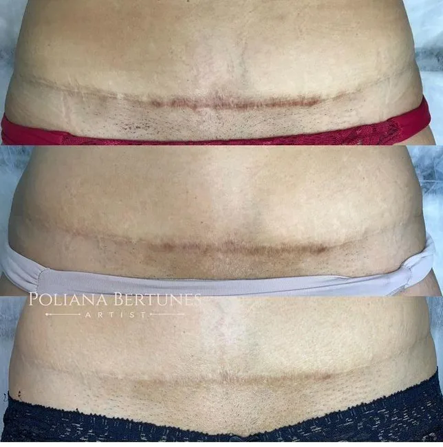 Camuflagem — sessões