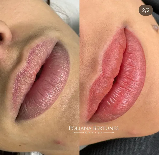 Micropigmentação lábios