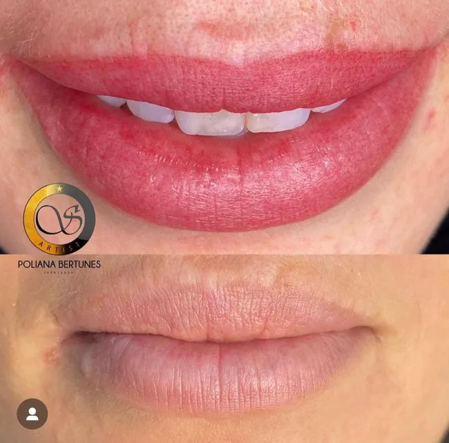 Micropigmentação lábios