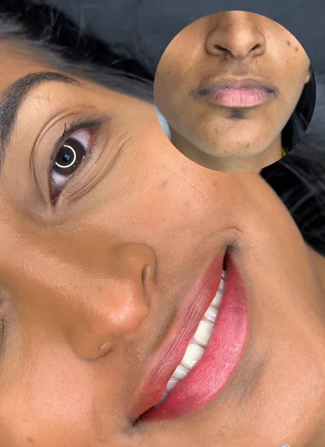 Micropigmentação lábios